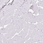 Immunohistochemical staining of human skeletal muscle shows no positivity in myocytes as expected.