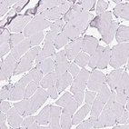 Immunohistochemical staining of human skeletal muscle shows no positivity in myocytes as expected.