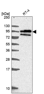 Western blot analysis in human cell line RT-4.