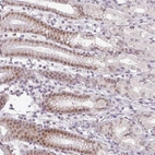 Anti-FAM65C Antibody
