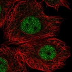 Immunofluorescent staining of human cell line MCF7 shows localization to nucleoplasm.