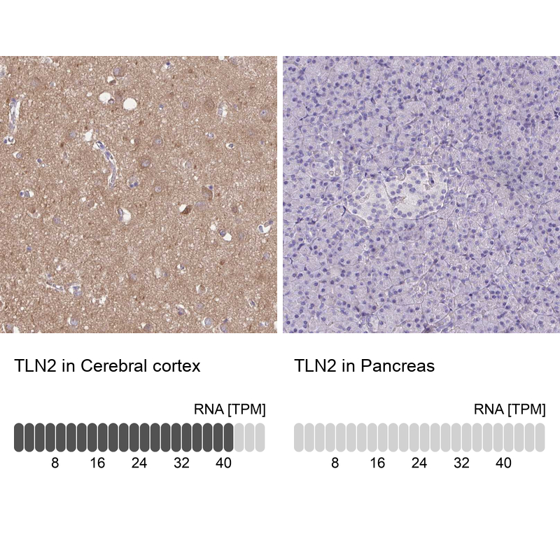 Anti-TLN2 Antibody