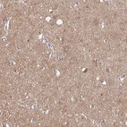 Immunohistochemical staining of human cerebral cortex shows high expression.