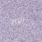 Anti-TLN2 Antibody