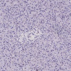 Immunohistochemical staining of human pancreas shows low expression as expected.