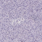 Immunohistochemical staining of human pancreas shows low expression as expected.