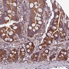 Anti-PAFAH1B2 Antibody