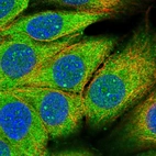 Immunofluorescent staining of human cell line MCF7 shows localization to nucleoli fibrillar center & cytosol.