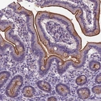 Anti-TM4SF20 Antibody