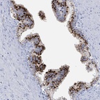 Anti-KLK4 Antibody