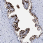 Immunohistochemical staining of human prostate shows high expression.