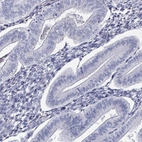 Immunohistochemical staining of human endometrium shows low expression as expected.