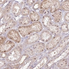 Anti-FAM222B Antibody