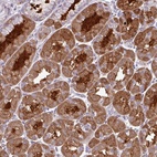 Anti-TMEM110 Antibody