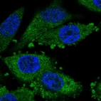 Immunofluorescent staining of human cell line PC-3 shows localization to cytosol.