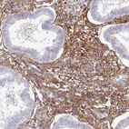 Immunohistochemical staining of human endometrium shows strong membranous positivity in stromal cells.