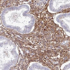 Immunohistochemical staining of human endometrium shows strong membranous positivity in stromal cells.