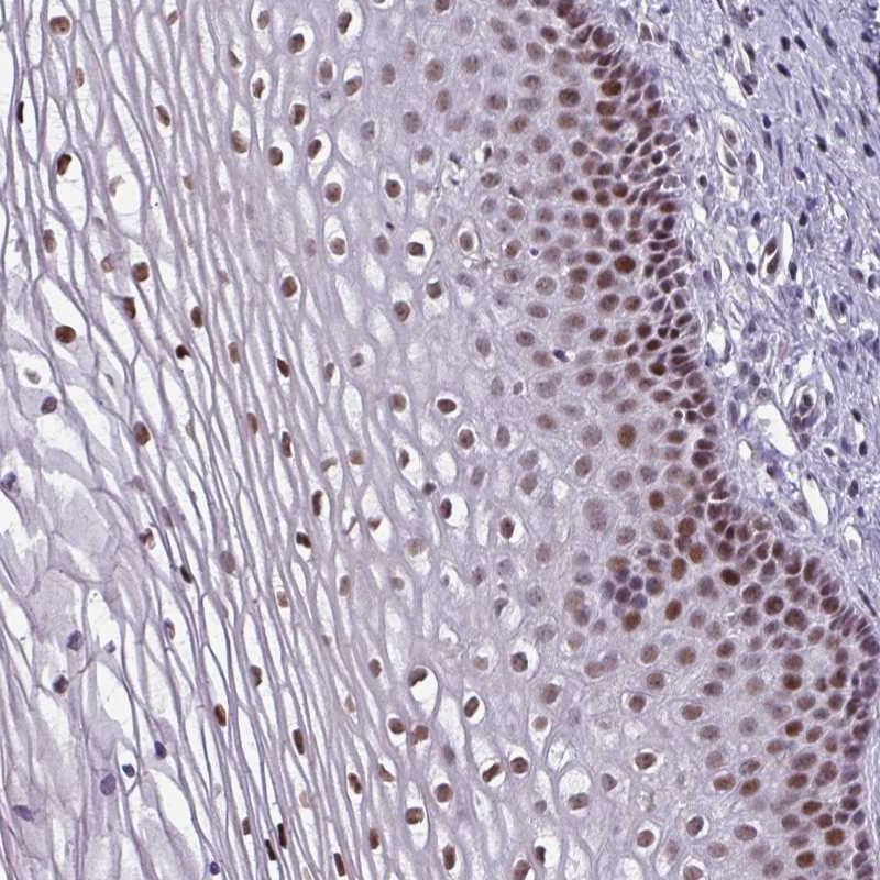 Anti-ZNF575 Antibody