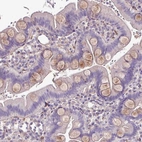Immunohistochemical staining of human small intestine shows moderate cytoplasmic positivity in goblet cells.