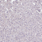 Immunohistochemical staining of human liver shows no positivity in hepatocytes as expected.