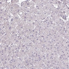 Immunohistochemical staining of human liver shows no positivity in hepatocytes as expected.