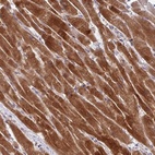 Anti-AKIRIN1 Antibody