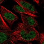 Immunofluorescent staining of human cell line U-251 MG shows localization to nucleoplasm.