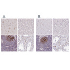 Immunohistochemical staining of human cerebral cortex, liver, lymph node and testis using Anti-TMEM119 antibody HPA051870 (A) shows similar protein distribution across tissues to independent antibody HPA052650 (B).