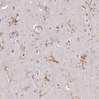 Immunohistochemical staining of human cerebral cortex shows moderate membranous positivity in microglia.
