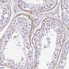 Immunohistochemical staining of human testis shows moderate cytoplasmic positivity in peritubular myoid cells.