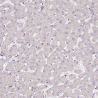 Immunohistochemical staining of human liver shows no positivity in hepatocytes as expected.