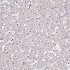 Immunohistochemical staining of human liver shows no positivity in hepatocytes as expected.