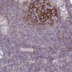 Immunohistochemical staining of human lymph node strong positivity in reticular fibers in germinal center cells.