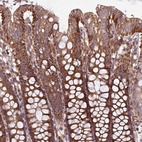Anti-PLEKHD1 Antibody