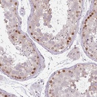 Anti-CHTF8 Antibody