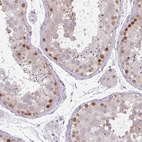 Anti-CHTF8 Antibody