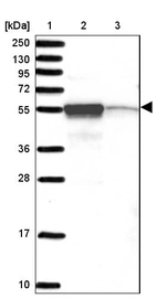 Lane 1: Marker [kDa] 250, 130, 95, 72, 55, 36, 28, 17, 10_br/_Lane 2: Human cell line RT-4_br/_Lane 3: Human cell line U-251MG sp