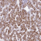 Anti-ANKRD13B Antibody