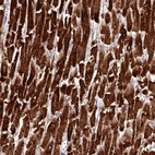 Immunohistochemical staining of human heart muscle shows high expression.