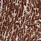 Immunohistochemical staining of human heart muscle shows high expression.