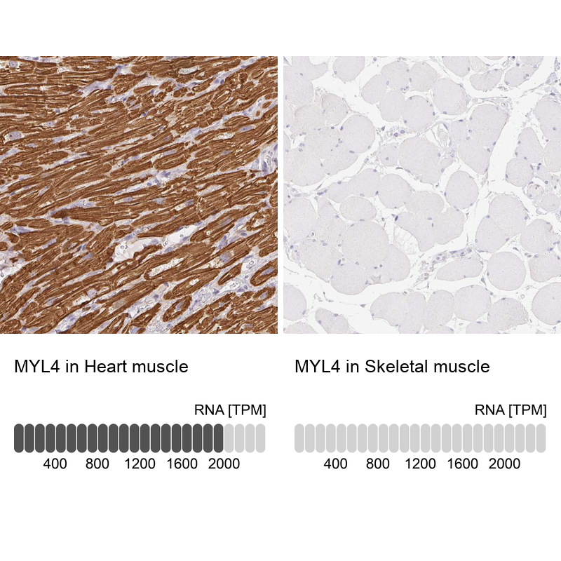 Anti-MYL4 Antibody