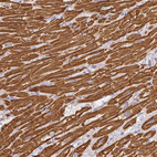 Immunohistochemical staining of human heart muscle shows strong cytoplasmic positivity in myocytes.