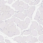 Immunohistochemical staining of human skeletal muscle shows no positivity in myocytes as expected.