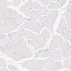 Immunohistochemical staining of human skeletal muscle shows no positivity in myocytes as expected.