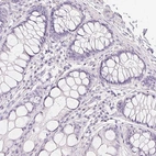 Immunohistochemical staining of human colon shows no positivity in glandular cells as expected.