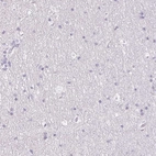 Immunohistochemical staining of human cerebral cortex shows no positivity in neurons as expected.