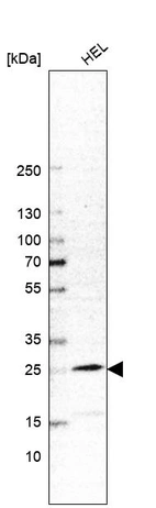 Western blot analysis in human cell line HEL.