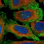 Immunofluorescent staining of human cell line U-2 OS shows localization to plasma membrane.