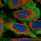 Immunofluorescent staining of human cell line U-2 OS shows localization to plasma membrane.