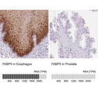 Anti-FABP5 Antibody